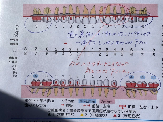 お口の老化は要注意！口腔内の乱れは腸認知症にも影響？！お口のエイジングケアを今すぐ始めよう_6_2