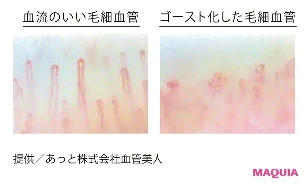 免疫細胞の「通路」は毛細血管