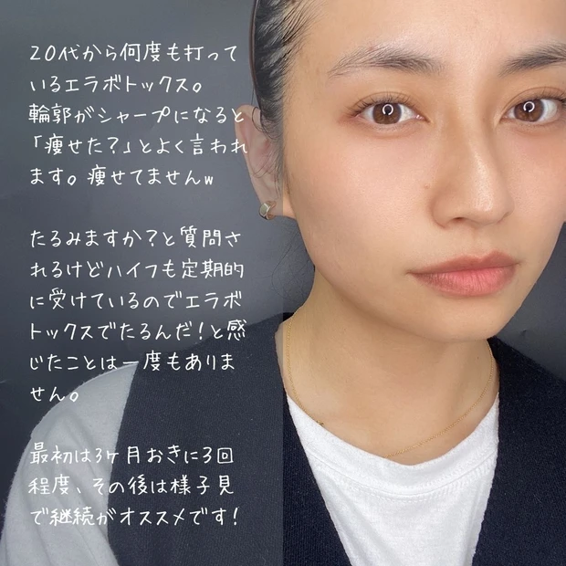 エラボトックス