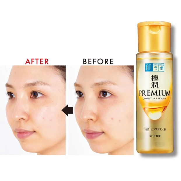 「肌ラボ 極潤プレミアム ヒアルロン液」の実力やいかに!?  30日お試…