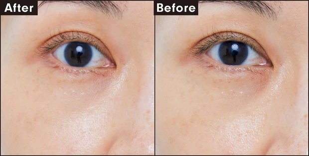 RMK コレクティング ヴェール コンシーラー 03 カバー力を検証