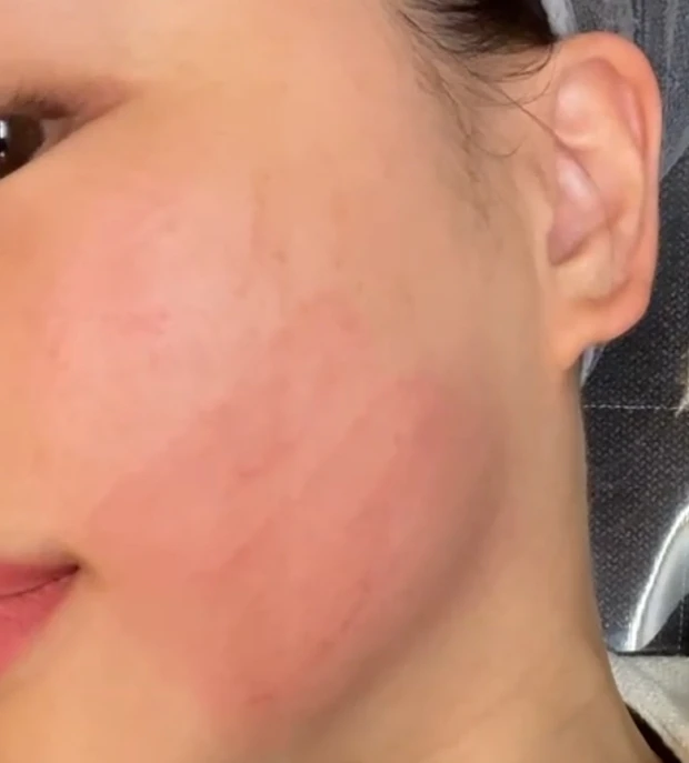 【必見】2024年やってよかった美容♡美容医療・ホームケア・美顔器、効果があったのはコレ！_5_1