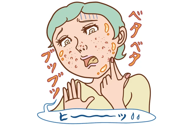 皮脂過多による肌トラブル