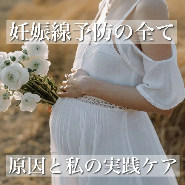 妊娠線予防はいつから始める？原因と私が実践した3ステップケア