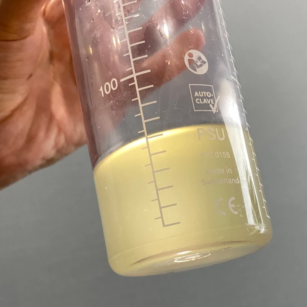 やまさや、ついに美容医療デビューしました♡︎【ハイドラフェイシャル体験レポート】_9_2