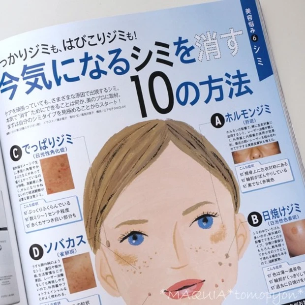 そのシミ、何ジミ!?シミにも種類があって対処法も違うんです!MAQUIA7月号で美白のお勉強しましょ☆