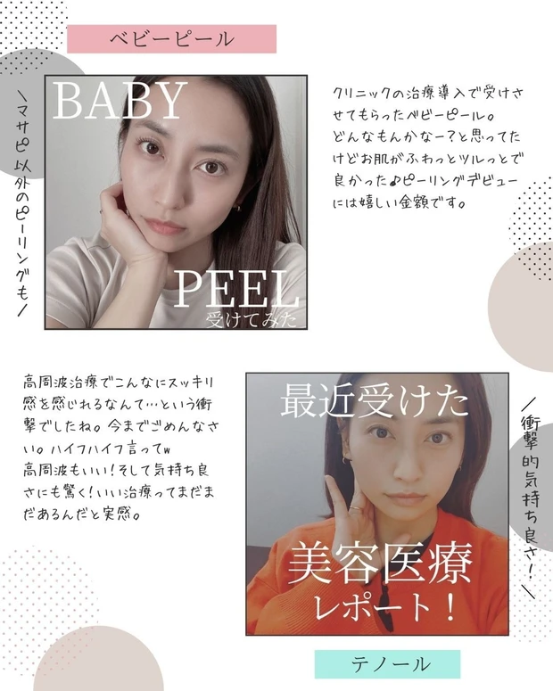 【2021年総まとめ】今年受けた美容医療!徹底解説!_6_1