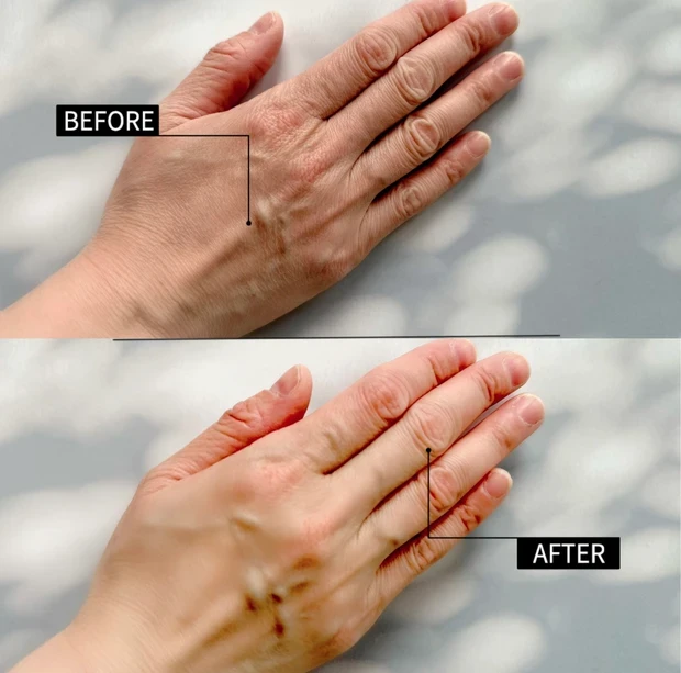 カシー ボザール マニュアン 使用前・使用後