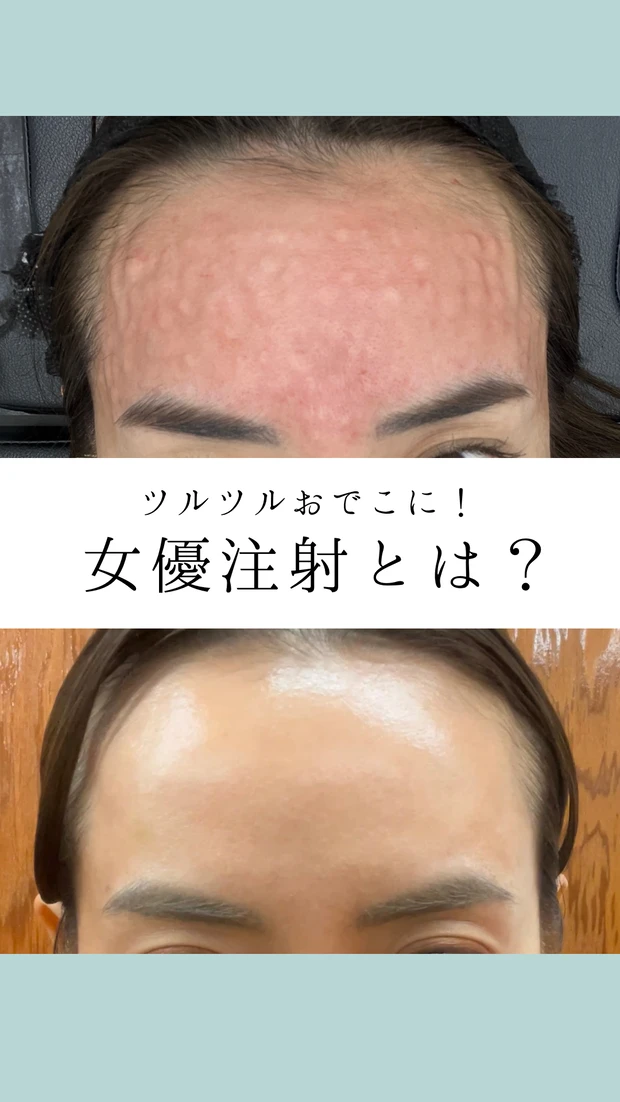 私が実践する【投資美容】3選！_1_1