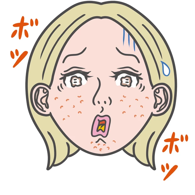 ニキビはこうして悪化する。メカニズムを図解&治安を守るための基本ケアも伝授