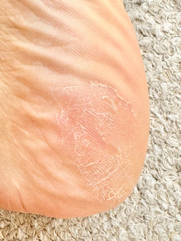 【検証】オルビスのディフェンセラでガサガサかかとがつるんとなるまでの4ヶ月を記録！_3_2