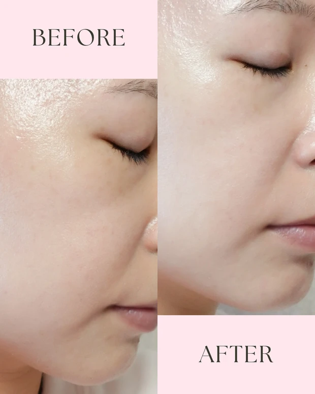 エレガンス モデリング カラーベース YE401を使用したビフォーアフター比較画像。ビフォーでは顔のくすみや色ムラが見え、アフターではイエロー下地でトーンが整い、肌がつるんと明るく仕上がっている。