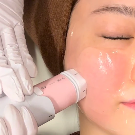 【ダウンタイムなしでたるみ軽減！】年末ご褒美美容医療「ハイドラジェントル×ボルニューマ」2週間後経過_5