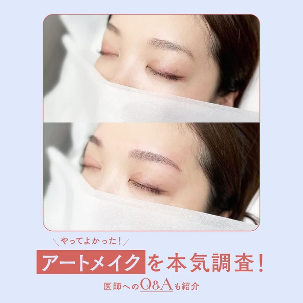 美容好きの「やってよかったアートメイク」TOP3を徹底調査！【医師監修・アートメイクQ&Aつき】