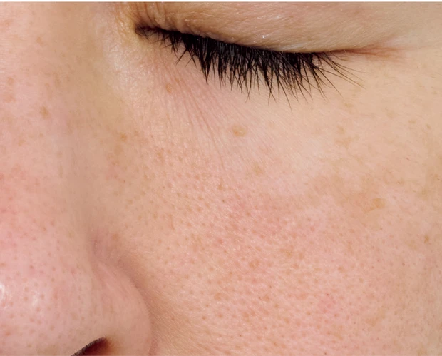 【悩み別】毛穴を目立たなくする方法 PhotoGallery_1_29