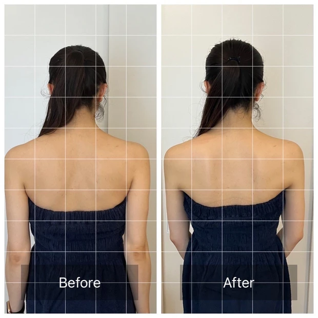 【7年目も内面美容を極めたい】アトピー肌×ハーフ顔bekiが目指すはストイックビューティー_4