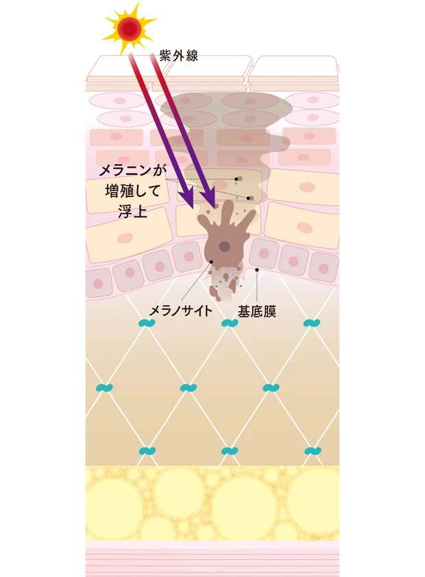 【トラブル肌のメカニズム】シミ、シワ、たるみ、乾燥、毛穴etc.におすすめのコスメ_1_17