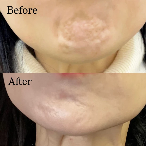 【韓国美容】韓国旅行で行ったクリニックをご紹介♡大満足の施術は...?_6