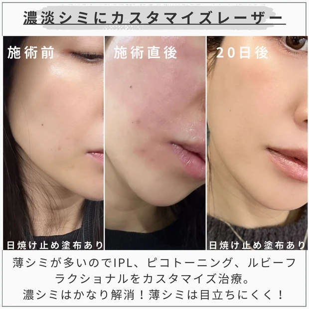 MAQUIAエキスパート MAQUIAブロガー talico