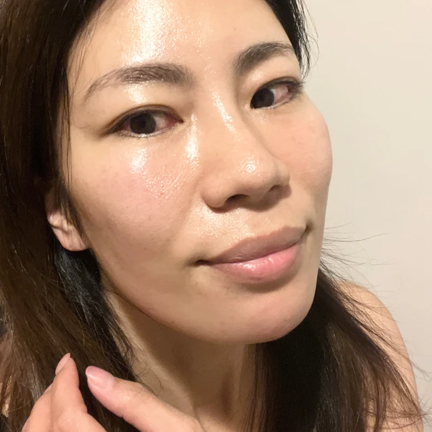 10月のマキアサロンへ行かれた方へ、元エステティシャンの私がおすすめするエステ【石井クリニックメディカルエステサロン】の予約をとって!クーポンの期限は年内!
_4_2