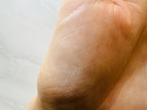 レカルカのスキンスムーサーのテクスチャー