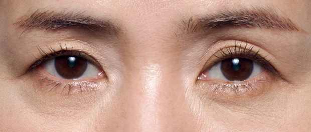 黒ぐま×たるみぐまタイプのくまカバー&涙袋メイクのテクニック アフター