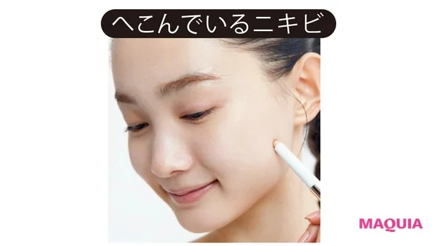 こんなときどうしたらいい? 肌作りのお悩みを解決!_Q ニキビを隠すテクが知りたい!_A ニキビのタイプ別にコンシーラーの質感を選択_へこんでいるニキビ