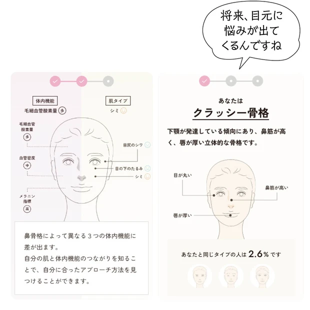 鼻骨格チェック クラッシー骨格タイプ