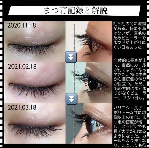 水橋保寿堂製薬 エマーキット 効果 記録 実際 変化