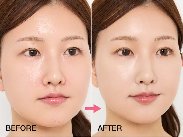 マキアインフルエンサー なーこさん 赤み&ニキビ悩み BEFORE➡AFTER ヘア&メイク 小澤桜 プチプラコスメ お悩み カバーメイク ベースメイク 赤み ニキビ 2026春新作