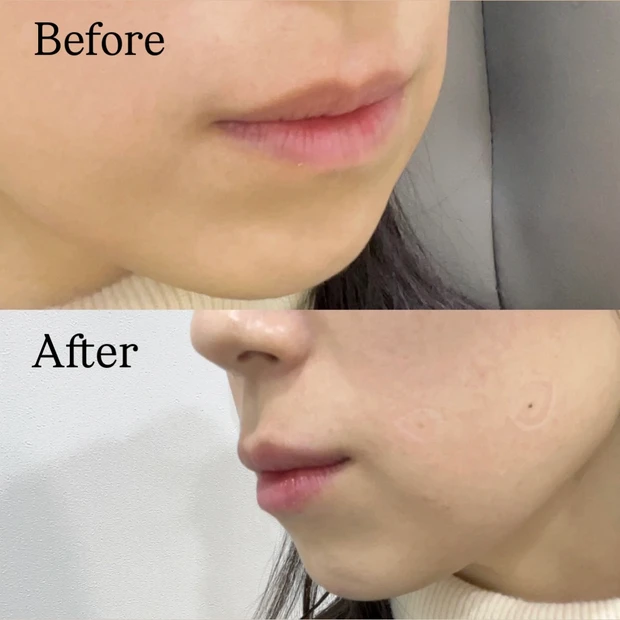 【韓国美容】韓国旅行で行ったクリニックをご紹介♡大満足の施術は...?_7