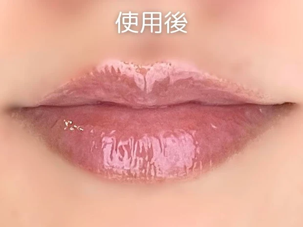 【トリデン リップ美容液 口コミ】ソリッドイン リップエッセンス