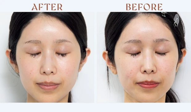 マキア　みんなのベスコス 2025年 上半期　ルルルン ハイドラ EX マスク　レビュー