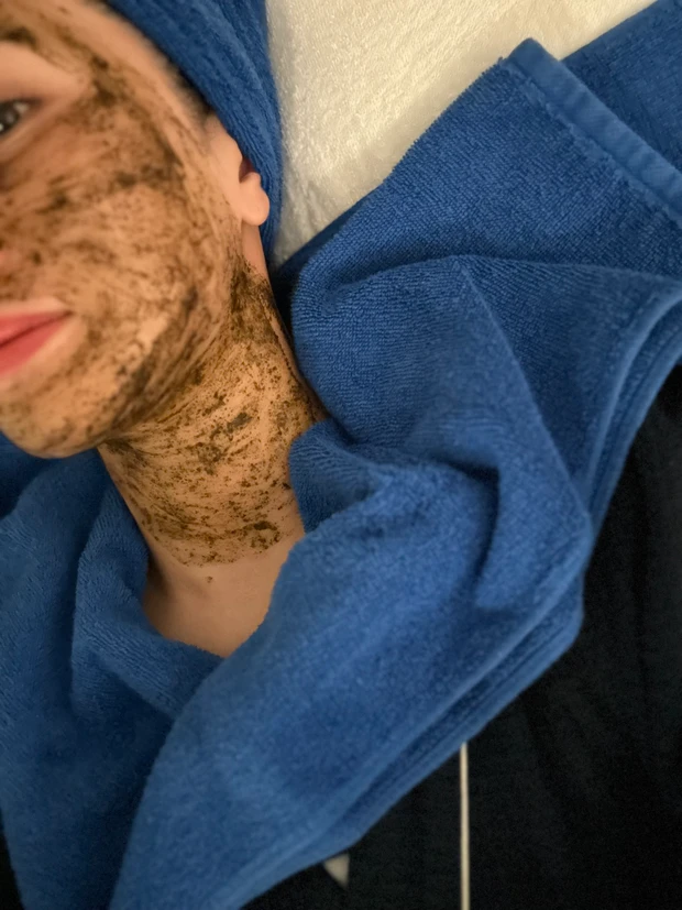 まるでむきたまご！今年やってよかった美容施術はこれ！ダウンタイムなし【𝑪𝑯𝑹𝑰𝑺𝑻𝑰𝑵𝑨 】ハーブピーリング_2