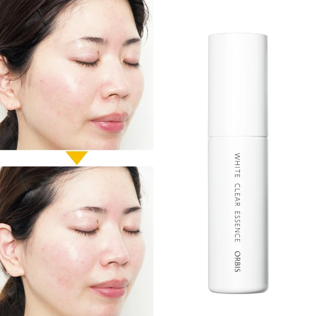 透明感が劇的アップ!「オルビス ホワイトクリアエッセンス」のお試し報告【…