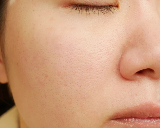 スキンプロテクトベース