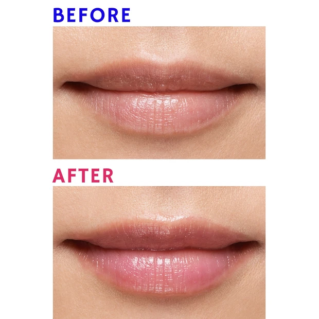 【悩み】唇の色がくすんでいる