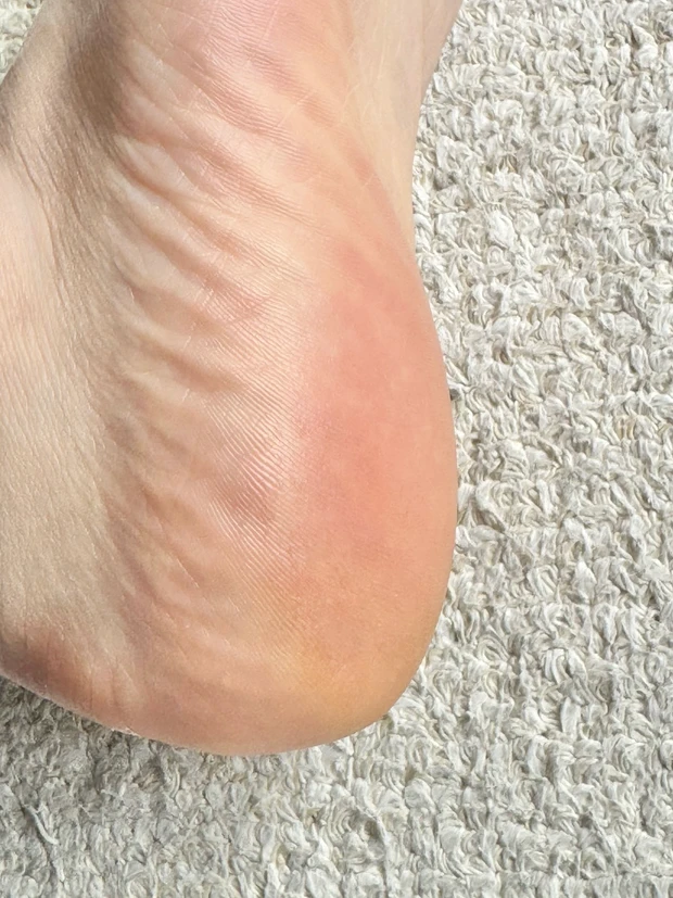 【検証】オルビスのディフェンセラでガサガサかかとがつるんとなるまでの4ヶ月を記録！_5_2