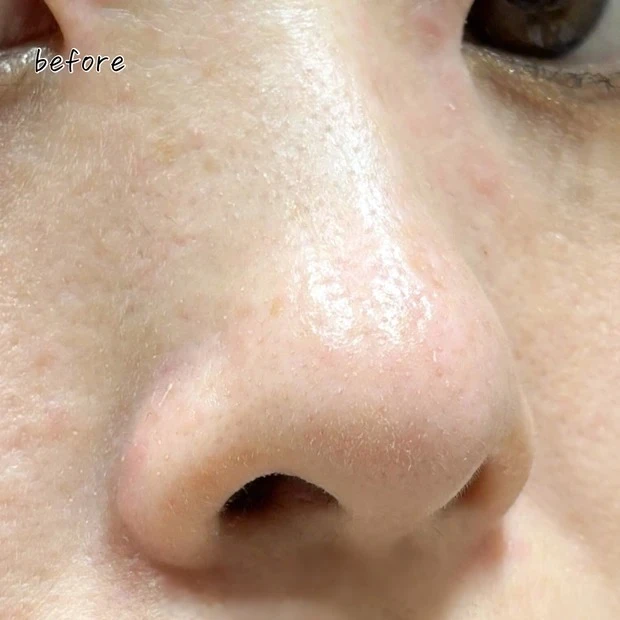 コスメデコルテ AQ 毛穴美容液オイルの口コミ 乾燥肌