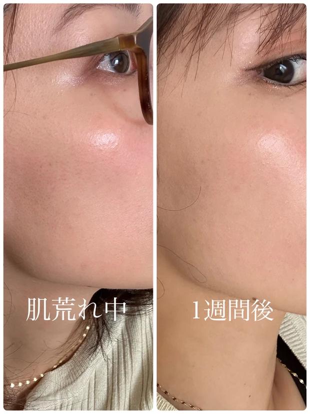 マデカクリーム　再生クリーム　シカクリーム 効果