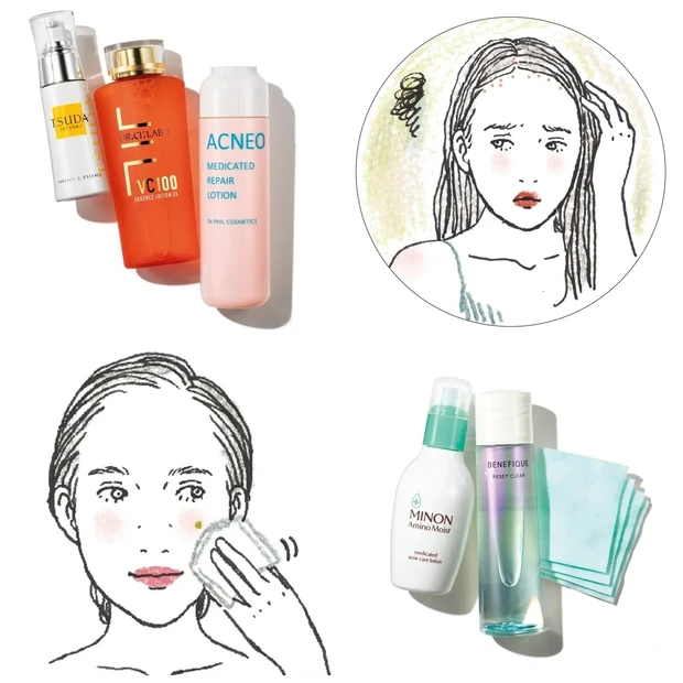 ニキビ ニキビ跡のお悩みに 化粧水 洗顔などおすすめスキンケアを専門家が解説 マキアオンライン Maquia Online