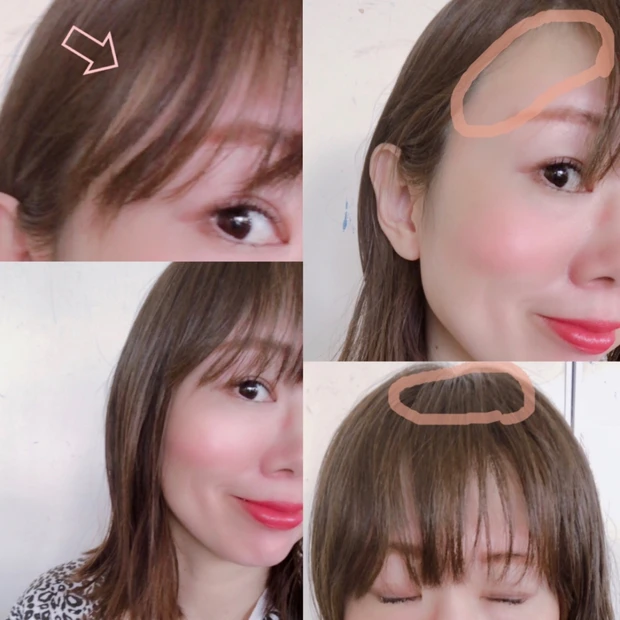 【女性の髪、薄毛のお悩み】アラフォーの私が経験した脱毛。ポジティブに過ごす対策、解決法