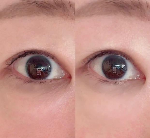 【Qoo10話題】40代の目元悩みに即アプローチ!塗るリフトアイクリーム!ビフォーアフター_5