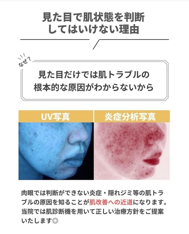 【30代で美容医療デビュー!】私が「初めての美容医療」に選んだクリニックの選択理由とその感想をレポートします!_6