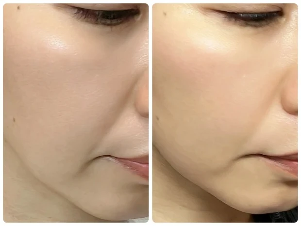 ルルルン ハイドラ PD マスクの口コミ Chie