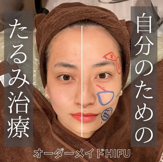 「美容皮膚科」と「美容外科」の違いについて解説します！_3_1