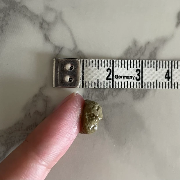 真夏の紫外線対策、何を重視していますか？_2