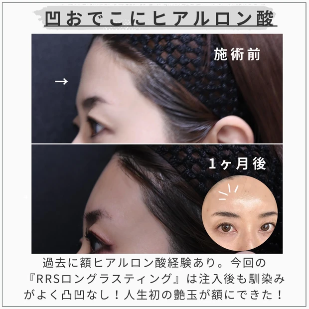 MAQUIAエキスパート MAQUIAブロガー talico