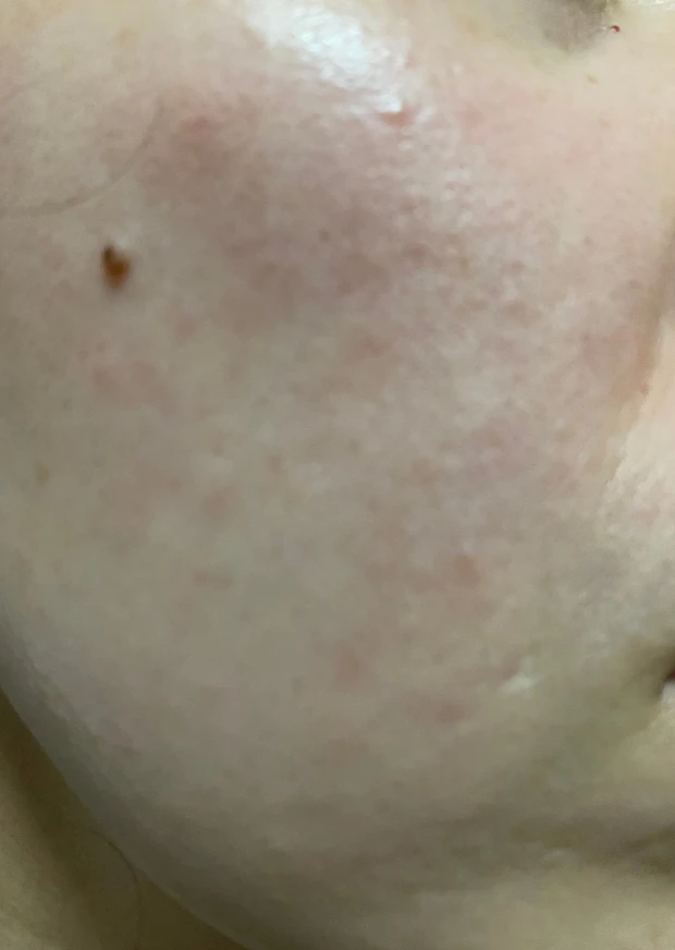 オバジ　オバジC25セラム NEO 美容液　ビタミンC