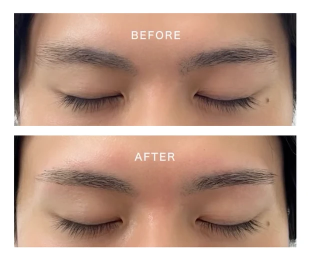 【ビフォーアフター公開】眉毛サロンで清潔感爆上がりしたアラサー美容男子の体験記！_2